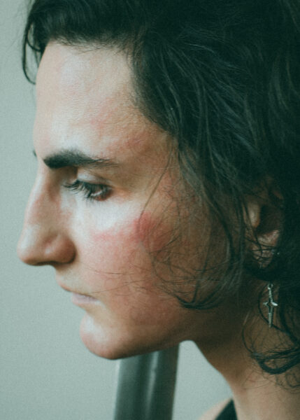 A close-up side profile of a person with long dark hair, visible blemishes on their cheek, and a star-shaped earring, looking downward against a neutral background.